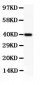 Anti-NFkB p100/p52 Picoband Antibody