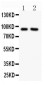 Anti-SLC9A1 Picoband Antibody