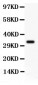 Anti-PD-L1/B7-H1 Antibody