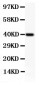 Anti-Perforin Picoband Antibody