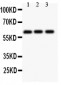 Anti-Perforin Picoband Antibody