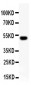 Anti-RUNX2 Picoband Antibody