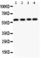 Anti-RUNX2 Picoband Antibody