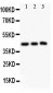 Anti-SIRT2 Picoband Antibody