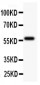 Anti-TdT Picoband Antibody