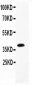 Anti-B Raf Picoband Antibody