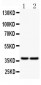 Anti-CD79a Picoband Antibody
