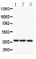 Anti-CD79b Picoband Antibody