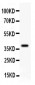 Anti-Decorin Picoband Antibody