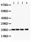 Anti-DHFR Picoband Antibody