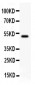 Anti-KAT3B/p300 Picoband Antibody