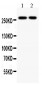 Anti-KAT3B/p300 Picoband Antibody