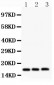 Anti-FHIT Picoband Antibody