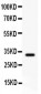 Anti-GST3/GST Pi Picoband Antibody