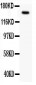 Anti-C-MET/HGFR Antibody