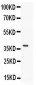 Anti-Caspase 3 Antibody