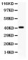 Anti-EDA Picoband Antibody