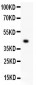 Anti-EDA Picoband Antibody