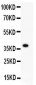 Anti-FGFR4 Picoband Antibody