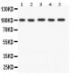 Anti-FGFR4 Picoband Antibody