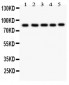 Anti-FOXM1 Picoband Antibody