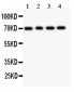 Anti-FOXO1A Picoband Antibody