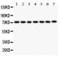 Anti-FOXO3A Picoband Antibody