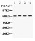 Anti-G6PD Picoband Antibody