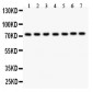 Anti-GCLC Picoband Antibody