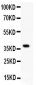 Anti-GRIA1 Picoband Antibody