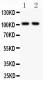 Anti-GRIA1 Picoband Antibody