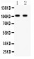 Anti-GRIA4 Picoband Antibody