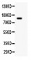 Anti-Gelsolin Picoband Antibody