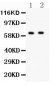 Anti-HEXB Picoband Antibody