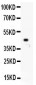 Anti-HNF1 Picoband Antibody