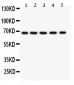 Anti-HNF1 Picoband Antibody