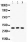 Anti-HOXA9 Picoband Antibody