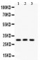 Anti-HOXA9 Picoband Antibody