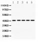 Anti-HOXA10 Picoband Antibody
