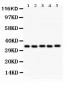 Anti-HOXA11 Picoband Antibody