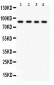 Anti-IKK Beta Picoband Antibody