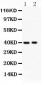 Anti-MUM1 Picoband Antibody