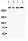 Anti-IP3 Receptor Picoband Antibody