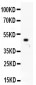 Anti-MCAK Picoband Antibody