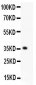 Anti-KLF6 Picoband Antibody