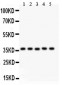 Anti-KLF6 Picoband Antibody