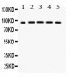 Anti-NR3C1 Picoband Antibody