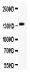 Anti-ZEB2 Picoband Antibody