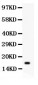 Anti-IL-16 Antibody