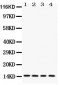 Anti-Galectin-1 Antibody